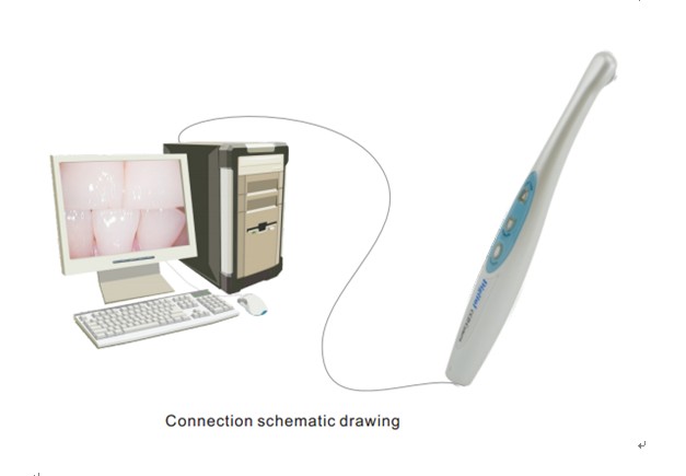 USB Intraoral Camera